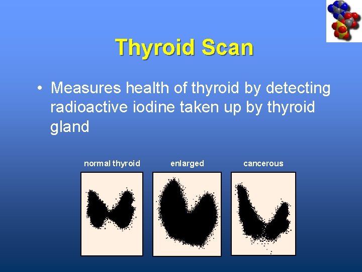 Thyroid Scan • Measures health of thyroid by detecting radioactive iodine taken up by