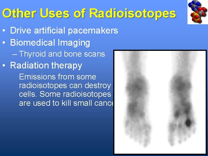 Other Uses of Radioisotopes • Drive artificial pacemakers • Biomedical Imaging – Thyroid and