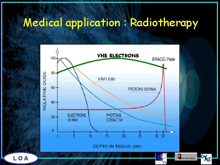 Medical application : Radiotherapy VHE ELECTRONS LOA 