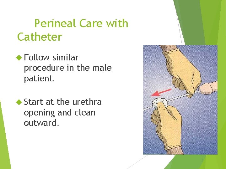 Perineal Care with Catheter Follow similar procedure in the male patient. Start at the