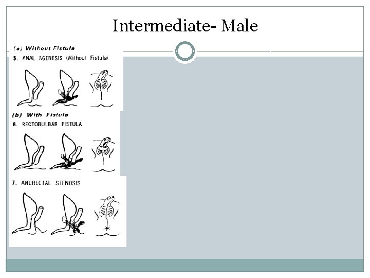 Intermediate- Male Intermediate- Male