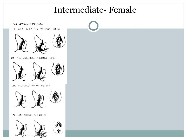 Intermediate- Female Intermediate- Female