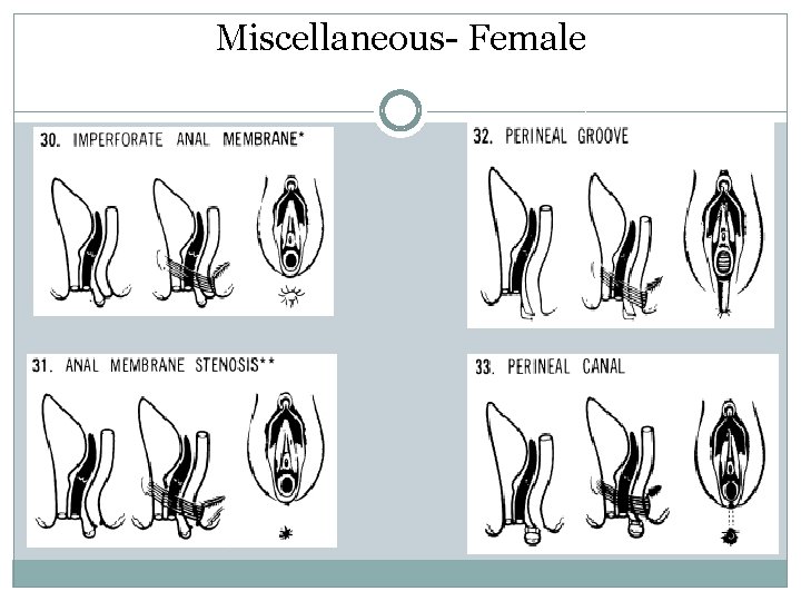 Miscellaneous- Female Miscellaneous- Female