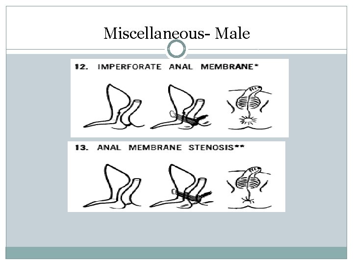 Miscellaneous- Male Miscellaneous- Male