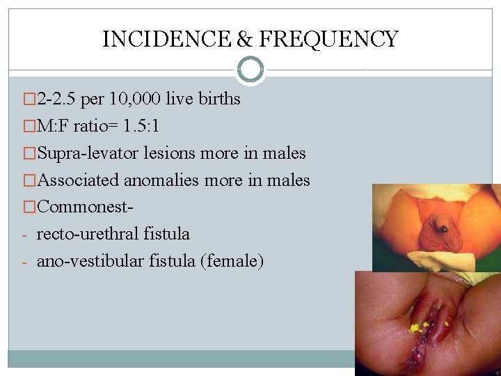 INCIDENCE & FREQUENCY � 2 -2. 5 per 10, 000 live births �M: F INCIDENCE & FREQUENCY � 2 -2. 5 per 10, 000 live births �M: F