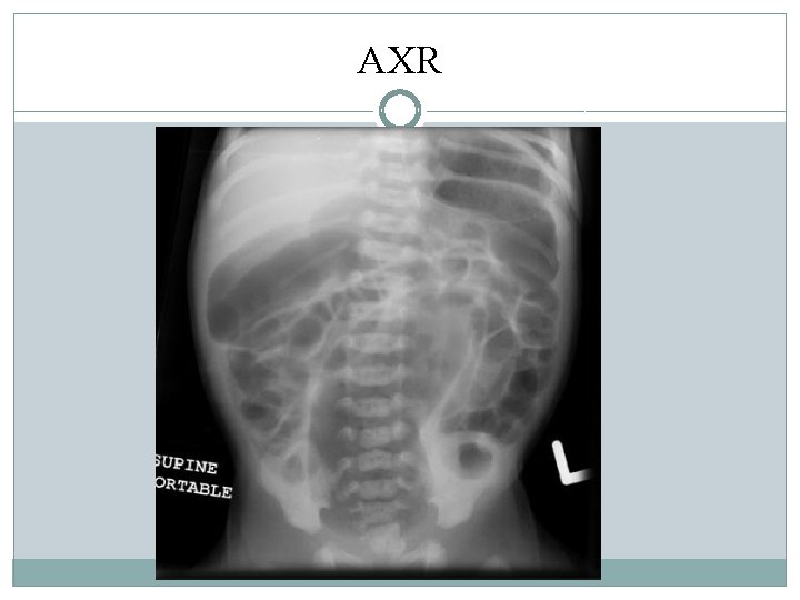 AXR AXR
