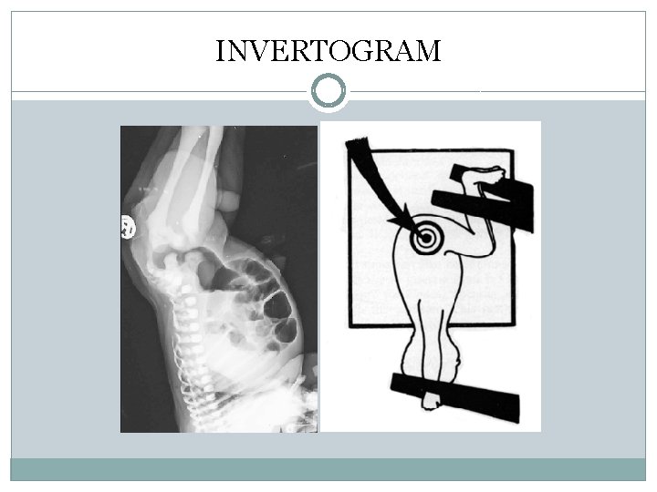 INVERTOGRAM INVERTOGRAM