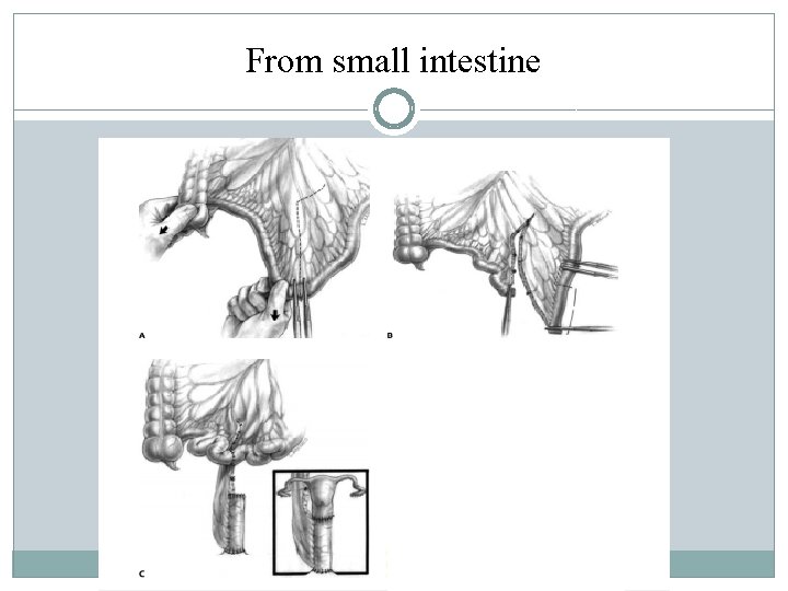 From small intestine From small intestine