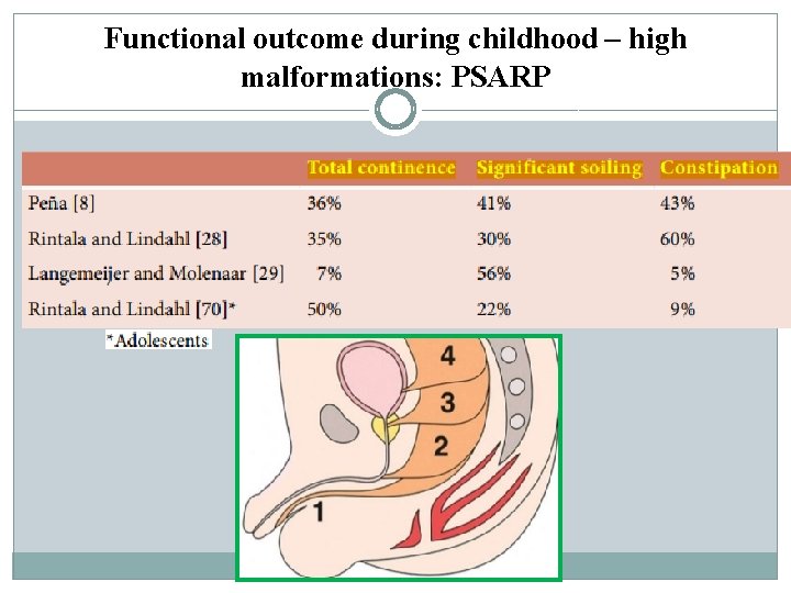 Functional outcome during childhood – high malformations: PSARP Functional outcome during childhood – high malformations: PSARP