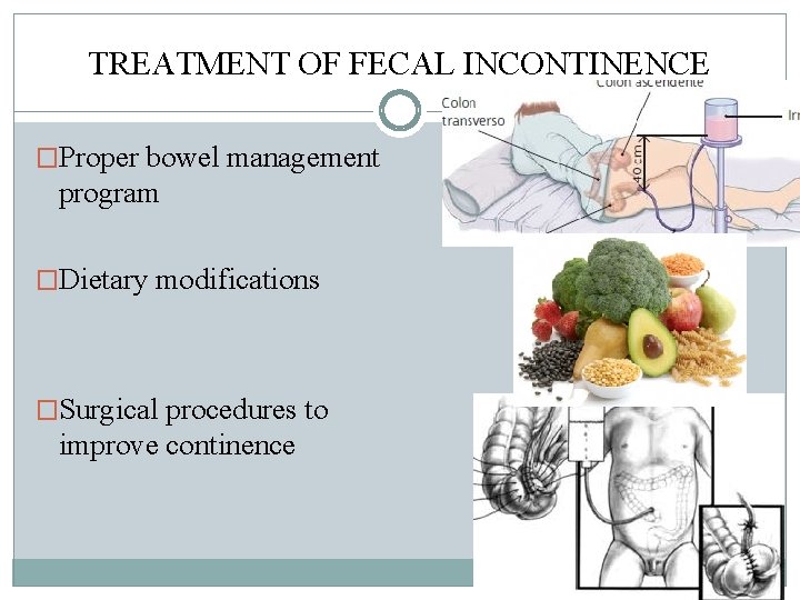TREATMENT OF FECAL INCONTINENCE �Proper bowel management program �Dietary modifications �Surgical procedures to improve TREATMENT OF FECAL INCONTINENCE �Proper bowel management program �Dietary modifications �Surgical procedures to improve
