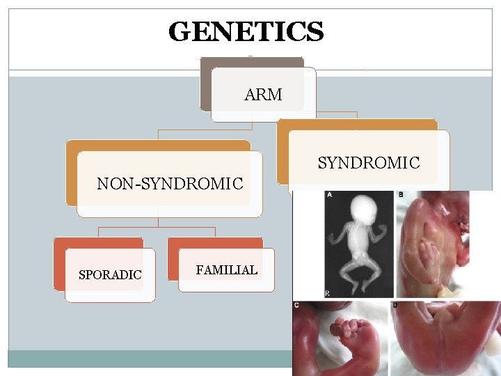 GENETICS ARM SYNDROMIC NON-SYNDROMIC SPORADIC FAMILIAL GENETICS ARM SYNDROMIC NON-SYNDROMIC SPORADIC FAMILIAL