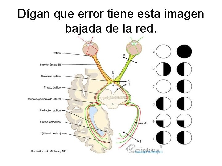 Dígan que error tiene esta imagen bajada de la red. 