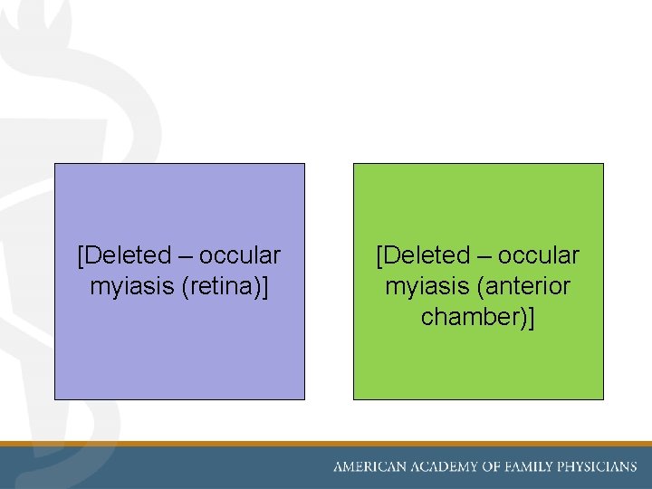 [Deleted – occular myiasis (retina)] [Deleted – occular myiasis (anterior chamber)] 