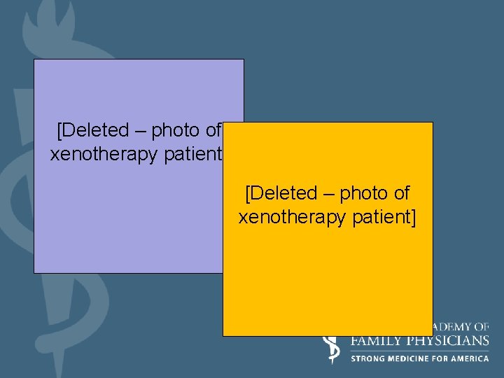 [Deleted – photo of xenotherapy patient] Therapeutic applications [Deleted – photo of xenotherapy patient]