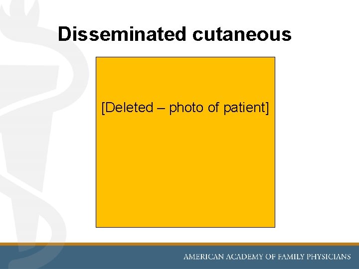 Disseminated cutaneous [Deleted – photo of patient] 