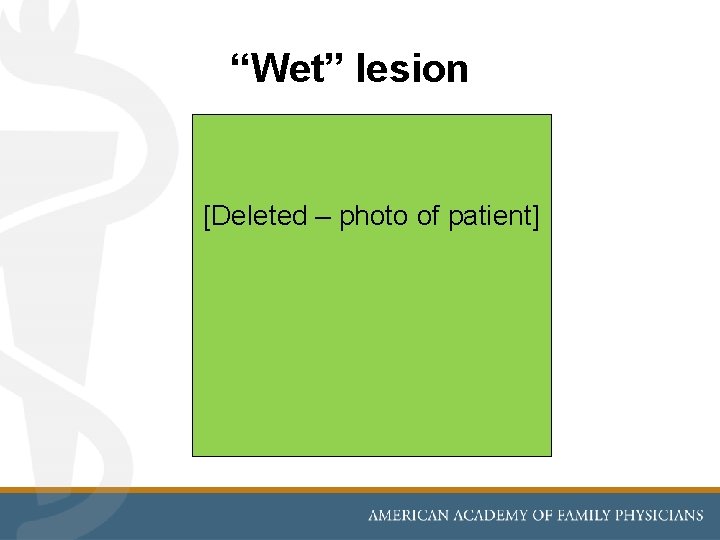 “Wet” lesion [Deleted – photo of patient] 