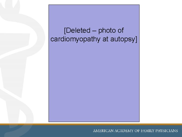 [Deleted – photo of cardiomyopathy at autopsy] 