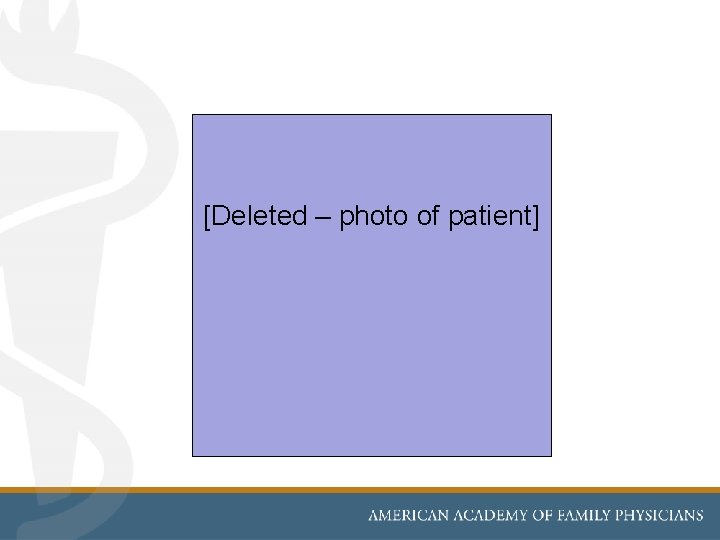 [Deleted – photo of patient] 