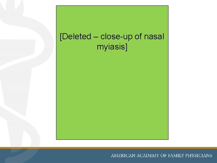 [Deleted – close-up of nasal myiasis] 