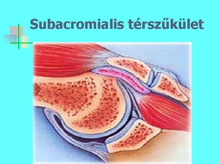 Subacromialis térszűkület 