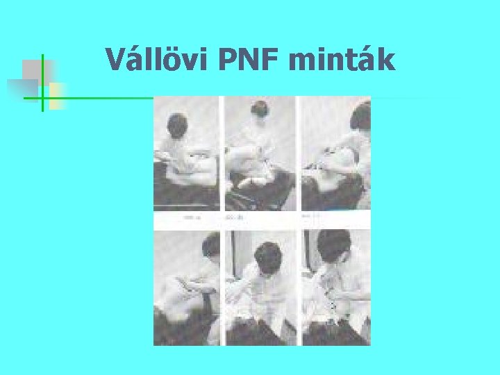 Vállövi PNF minták 