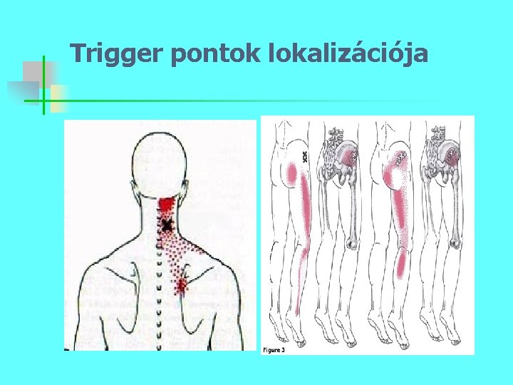 Trigger pontok lokalizációja 