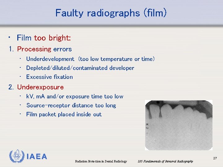 Faulty radiographs (film) • Film too bright: 1. Processing errors • Underdevelopment (too low Faulty radiographs (film) • Film too bright: 1. Processing errors • Underdevelopment (too low