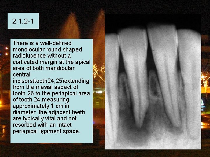 2. 1. 2 -1 There is a well-defined monolocular round shaped radiolucence without a