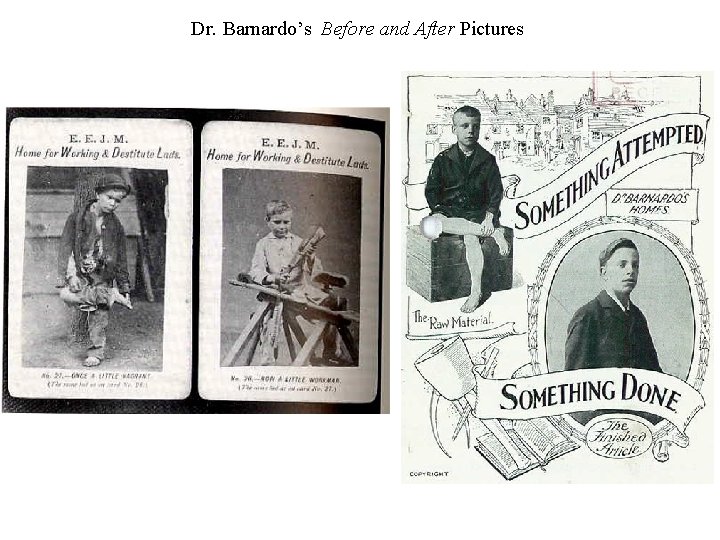 Dr. Barnardo’s Before and After Pictures 