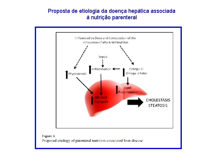 Proposta de etiologia da doença hepática associada à nutrição parenteral 