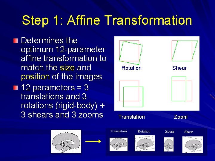 Step 1: Affine Transformation Determines the optimum 12 -parameter affine transformation to match the