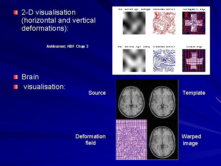 2 -D visualisation (horizontal and vertical deformations): Ashburner; HBF Chap 3 Brain visualisation: Source
