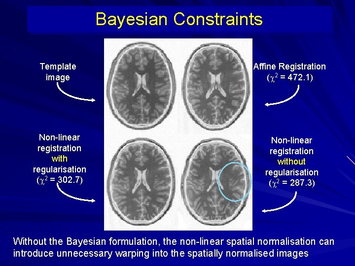 Bayesian Constraints Template image Affine Registration ( 2 = 472. 1) Non-linear registration with