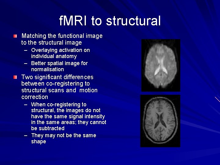 f. MRI to structural Matching the functional image to the structural image – Overlaying