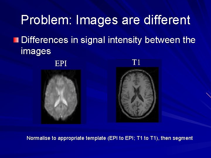 Problem: Images are different Differences in signal intensity between the images Normalise to appropriate