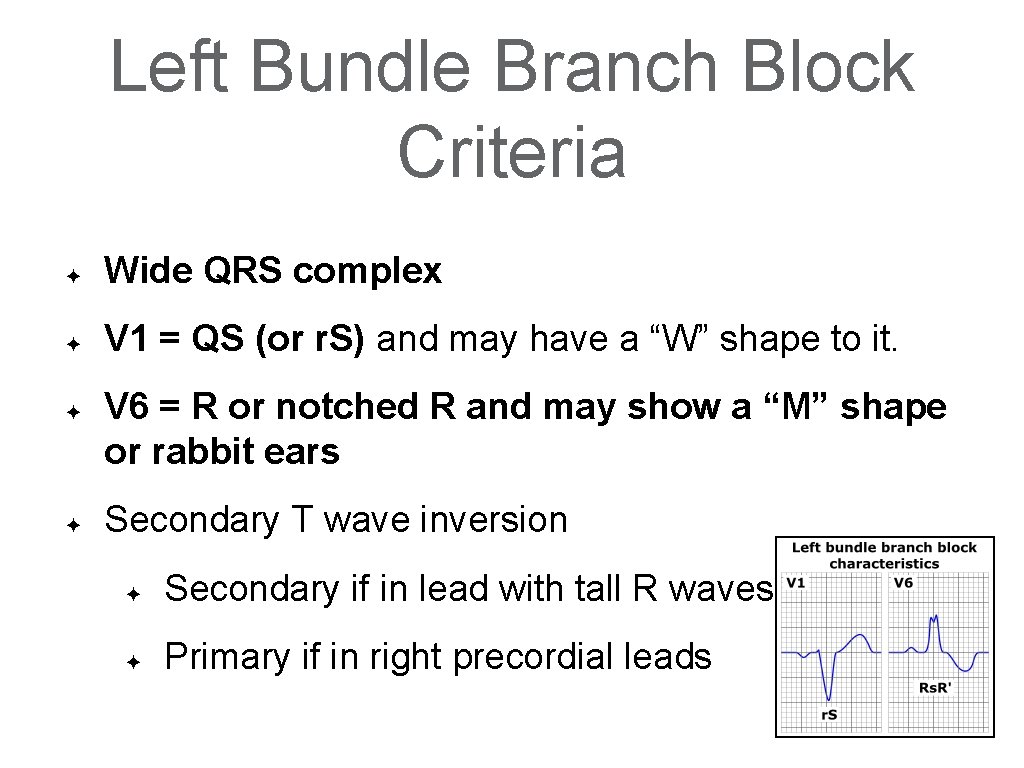 Left Bundle Branch Block Criteria ✦ Wide QRS complex ✦ V 1 = QS