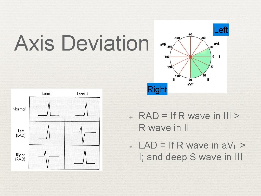 Axis Deviation Left Right ✦ ✦ RAD = If R wave in III >