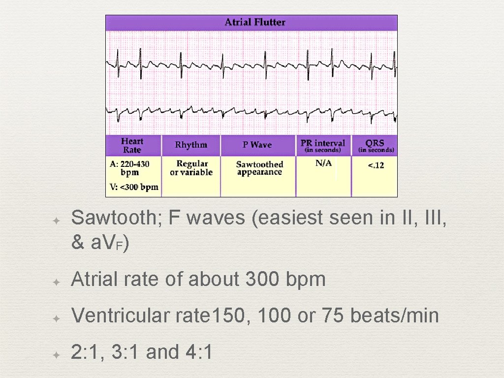 Atrial Flutter ✦ Sawtooth; F waves (easiest seen in II, III, & a. VF)