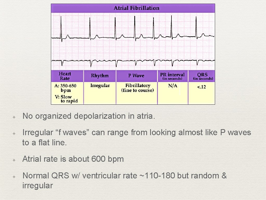 Atrial Fibrillation ✦ ✦ No organized depolarization in atria. Irregular “f waves” can range