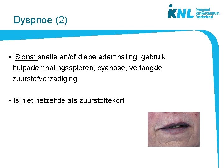 Dyspnoe (2) • ‘Signs: snelle en/of diepe ademhaling, gebruik hulpademhalingsspieren, cyanose, verlaagde zuurstofverzadiging •