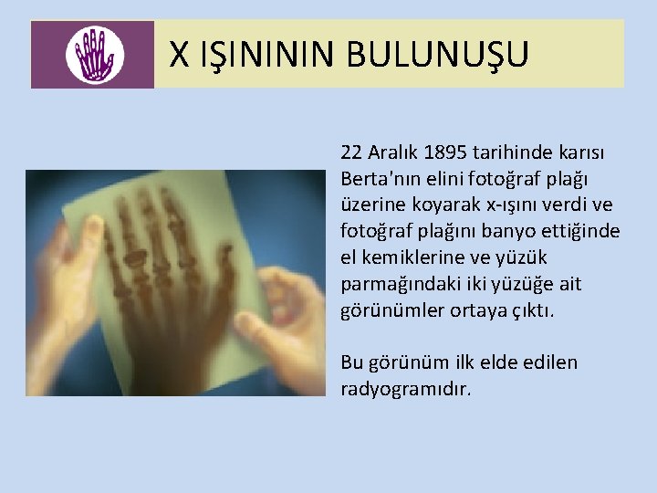 X IŞINININ BULUNUŞU 22 Aralık 1895 tarihinde karısı Berta'nın elini fotoğraf plağı üzerine koyarak