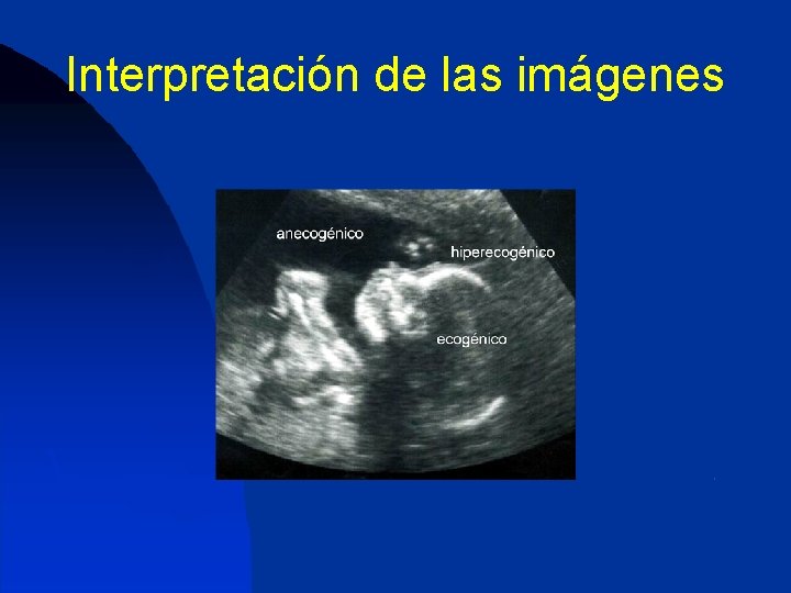 Interpretación de las imágenes 