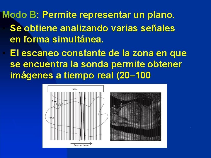 Modo B: Permite representar un plano. • Se obtiene analizando varias señales en forma