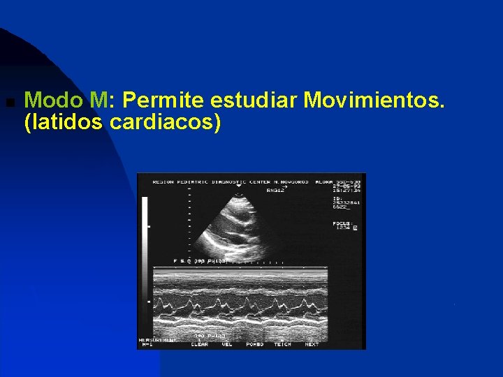 n Modo M: Permite estudiar Movimientos. (latidos cardiacos) 