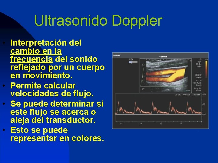 Ultrasonido Doppler • Interpretación del cambio en la frecuencia del sonido reflejado por un