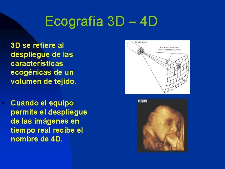 Ecografía 3 D – 4 D • 3 D se refiere al despliegue de