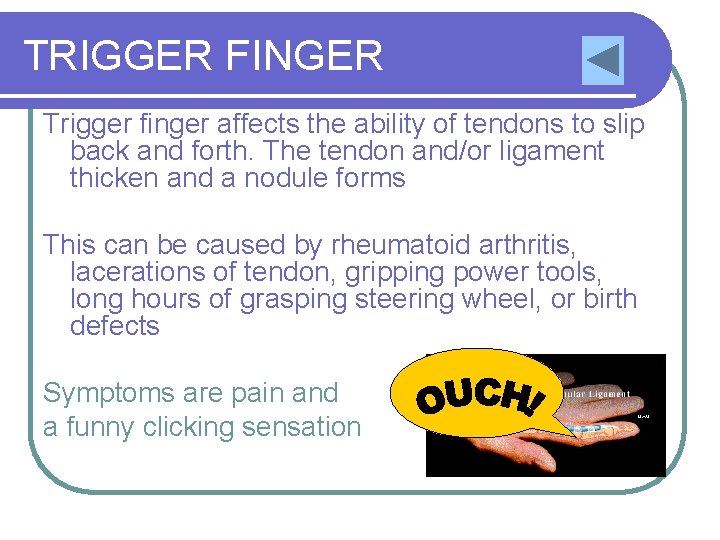 TRIGGER FINGER Trigger finger affects the ability of tendons to slip back and forth.