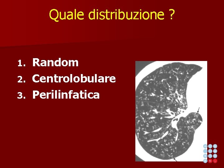 Quale distribuzione ? Random 2. Centrolobulare 3. Perilinfatica 1. 