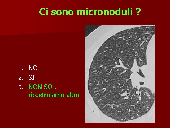 Ci sono micronoduli ? NO 2. SI 3. NON SO , ricostruiamo altro 1.