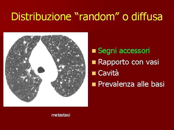 Distribuzione “random” o diffusa n Segni accessori n Rapporto con vasi n Cavità n